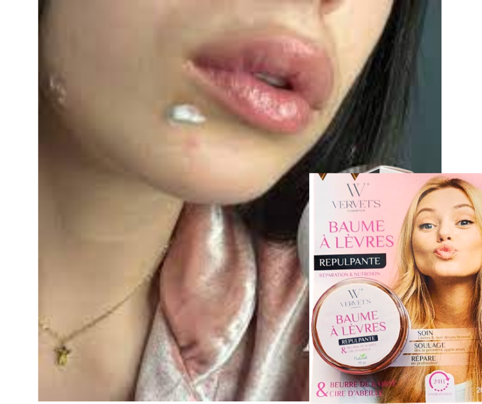 مضخم شفاه 👄 لشفاه اكثر اثارة و انوثة levre BOTOX